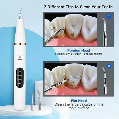 Smart Ultra-Sonic Teeth Cleaner